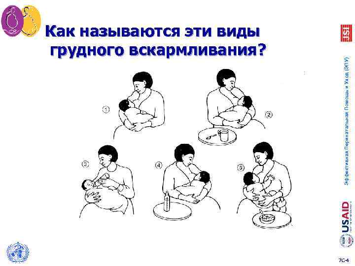 Эффективная Перинатальная Помощь и Уход (ЭПУ) Как называются эти виды грудного вскармливания? 7 C-4
