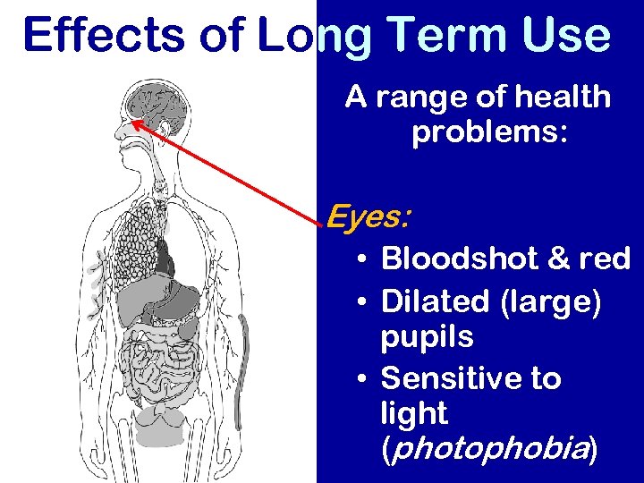 Effects of Long Term Use A range of health problems: Eyes: • Bloodshot &