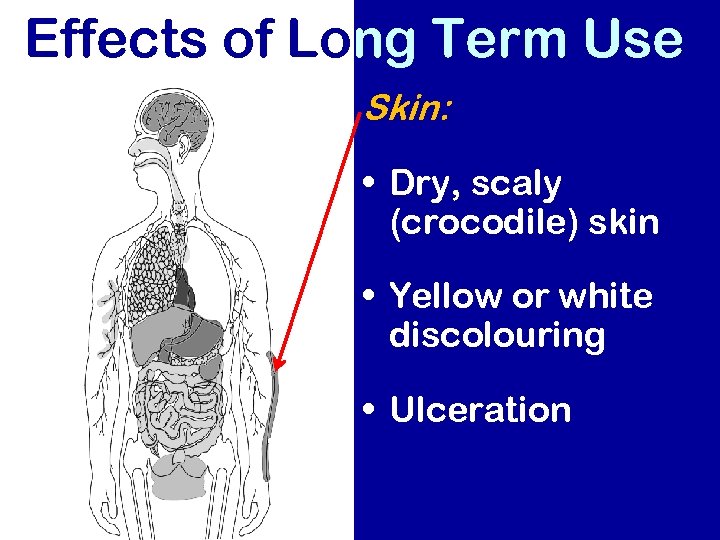 Effects of Long Term Use Skin: • Dry, scaly (crocodile) skin • Yellow or