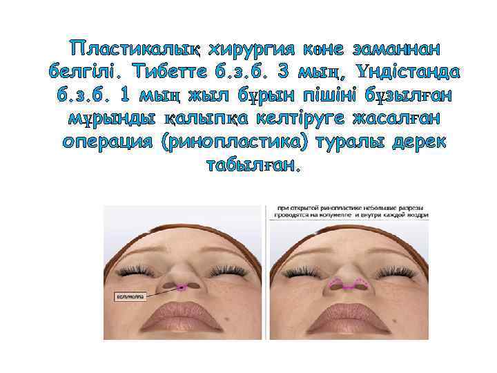 Пластикалық хирургия көне заманнан белгілі. Тибетте б. з. б. 3 мың, Үндістанда б. з.