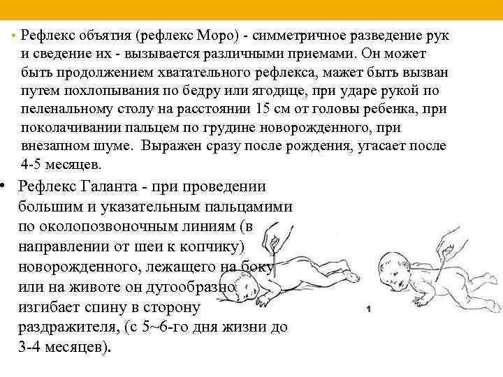  • Рефлекс объятия (рефлекс Моро) - симметричное разведение рук и сведение их -