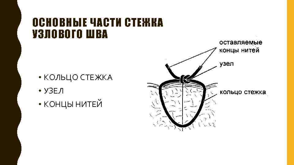 ОСНОВНЫЕ ЧАСТИ СТЕЖКА УЗЛОВОГО ШВА • КОЛЬЦО СТЕЖКА • УЗЕЛ • КОНЦЫ НИТЕЙ 