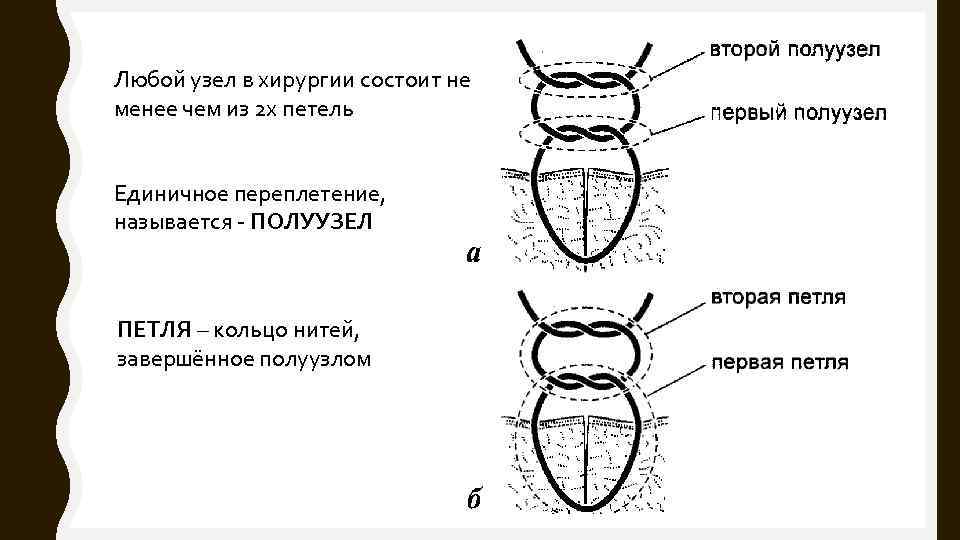 Любой узел в хирургии состоит не менее чем из 2 х петель Единичное переплетение,