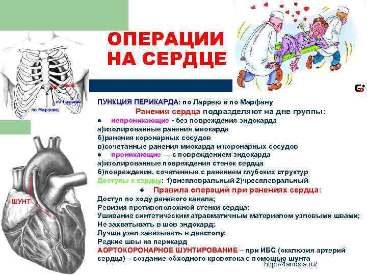 ОПЕРАЦИИ НА СЕРДЦЕ ПУНКЦИЯ ПЕРИКАРДА: по Ларрею и по Марфану Ранения сердца подразделяют на