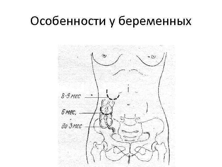 Блок схема аппендицит