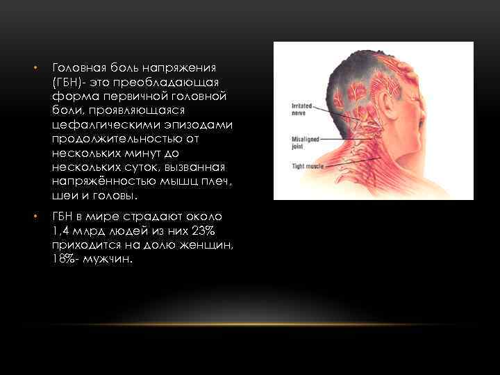  • Головная боль напряжения (ГБН)- это преобладающая форма первичной головной боли, проявляющаяся цефалгическими