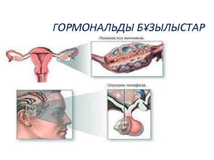 ГОРМОНАЛЬДЫ БҰЗЫЛЫСТАР 