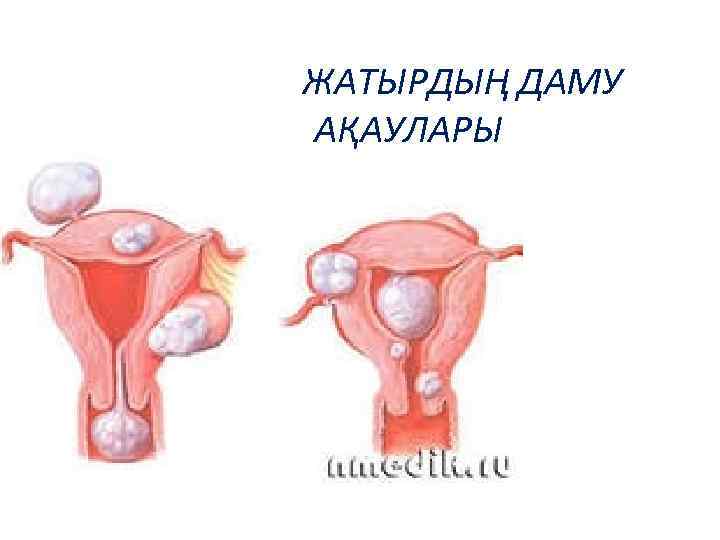 ЖАТЫРДЫҢ ДАМУ АҚАУЛАРЫ 