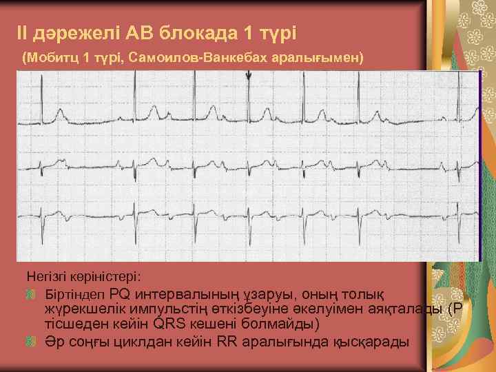 Ав блокада 2 мобитц 1