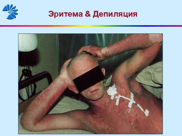 Эритема & Депиляция 