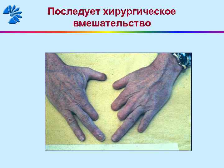 Последует хирургическое вмешательство 