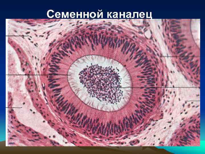 Семенной каналец 