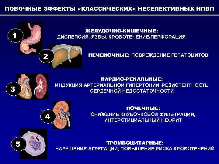 ПОБОЧНЫЕ ЭФФЕКТЫ «КЛАССИЧЕСКИХ» НЕСЕЛЕКТИВНЫХ НПВП ЖЕЛУДОЧНО-КИШЕЧНЫЕ: ДИСПЕПСИЯ, ЯЗВЫ, КРОВОТЕЧЕНИЕ/ПЕРФОРАЦИЯ 1 2 ПЕЧЕНОЧНЫЕ: ПОВРЕЖДЕНИЕ ГЕПАТОЦИТОВ
