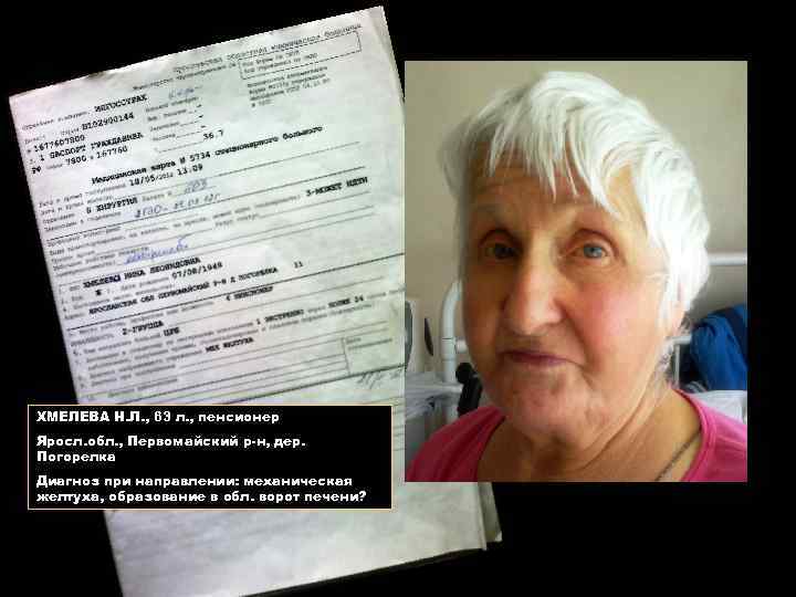 ХМЕЛЕВА Н. Л. , 63 л. , пенсионер Яросл. обл. , Первомайский р-н, дер.