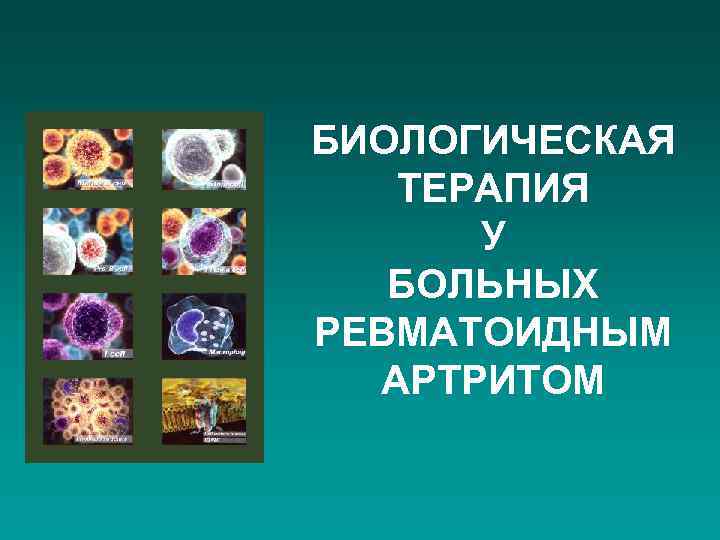 БИОЛОГИЧЕСКАЯ ТЕРАПИЯ У БОЛЬНЫХ РЕВМАТОИДНЫМ АРТРИТОМ 