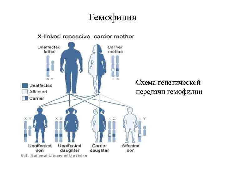 Гемофилия Схема генетической передачи гемофилии 