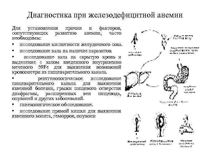 Диагностика при железодефицитной анемии Для установления причин и факторов, сопутствующих развитию анемии, часто необходимы: