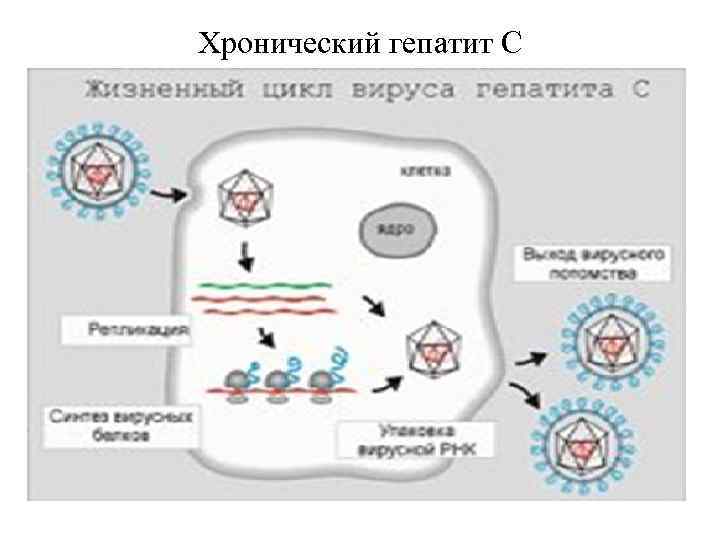 Хронический гепатит С 