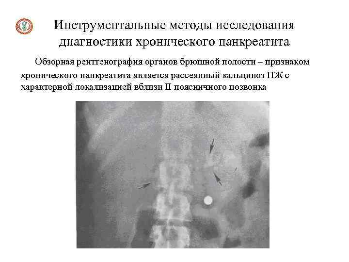 Методы диагностики органов брюшной полости