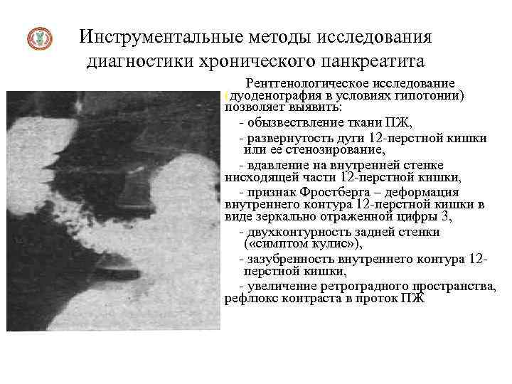 Инструментальные методы исследования диагностики хронического панкреатита Рентгенологическое исследование (дуоденография в условиях гипотонии) позволяет выявить: