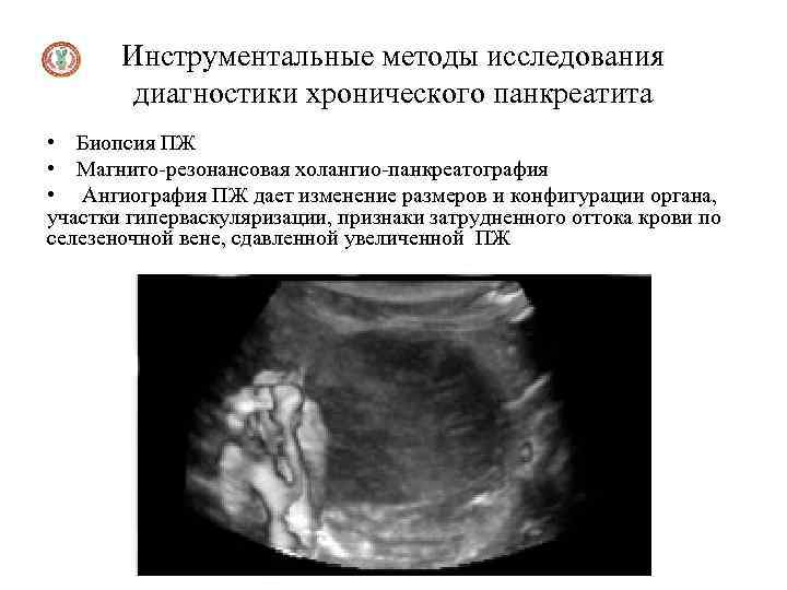 Инструментальные методы исследования диагностики хронического панкреатита • Биопсия ПЖ • Магнито-резонансовая холангио-панкреатография • Ангиография
