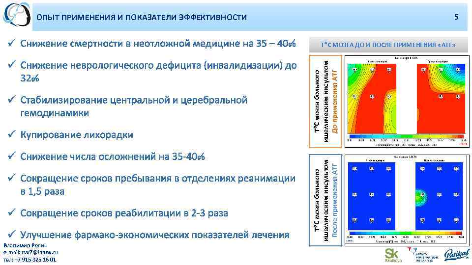 2 ОПЫТ ПРИМЕНЕНИЯ И ПОКАЗАТЕЛИ ЭФФЕКТИВНОСТИ 54 Т С мозга больного ишемическим инсультом После