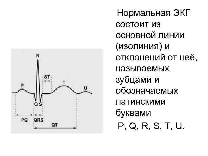  Нормальная ЭКГ состоит из основной линии (изолиния) и отклонений от неё, называемых зубцами