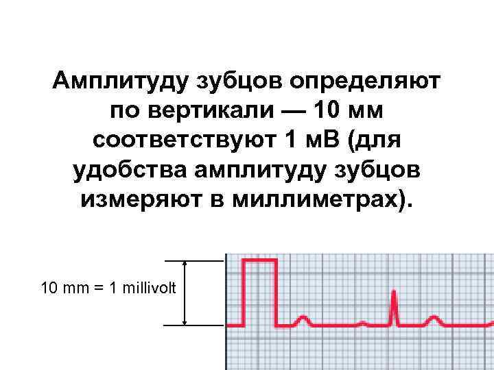 Амплитуда санкт петербурга. Измерение амплитуды зубцов. Определение амплитуды зубцов. Определите амплитуду зубца. Определить величину амплитуды зубцов.