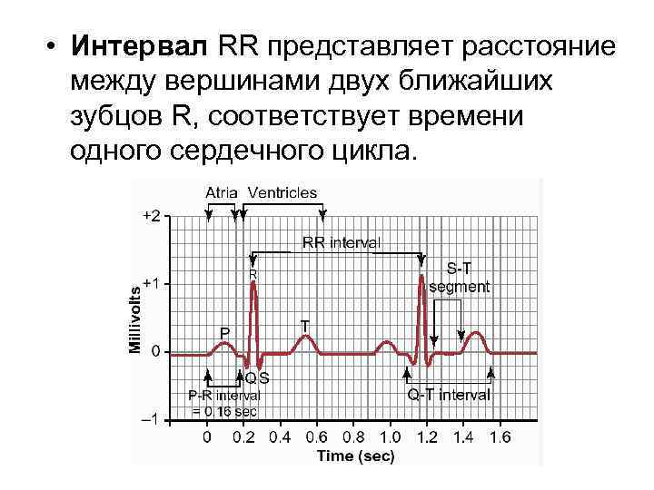  • Интервал RR представляет расстояние между вершинами двух ближайших зубцов R, соответствует времени