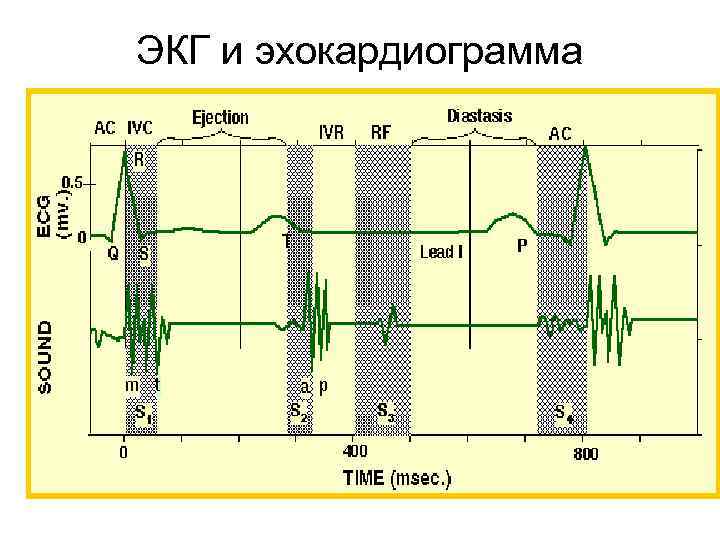 ЭКГ и эхокардиограмма 