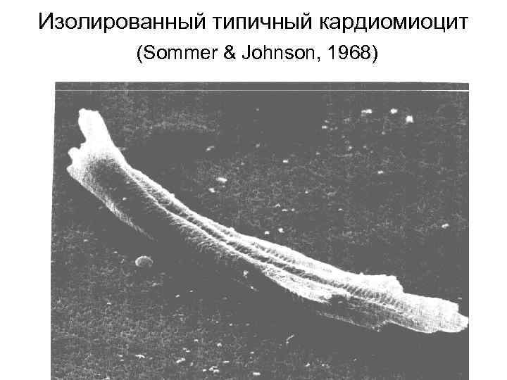 Изолированный типичный кардиомиоцит (Sommer & Johnson, 1968) 