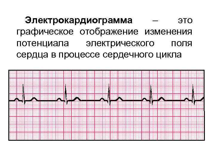 Электрокардиограмма – это графическое отображение изменения потенциала электрического поля сердца в процессе сердечного цикла