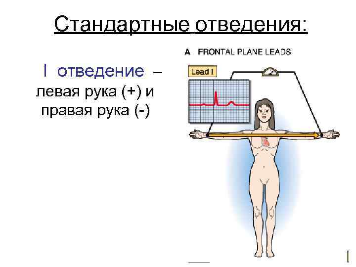 Стандартные отведения: I отведение – левая рука (+) и правая рука (-) 