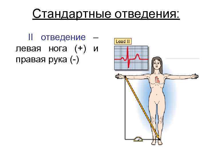 Стандартные отведения: II отведение – левая нога (+) и правая рука (-) 