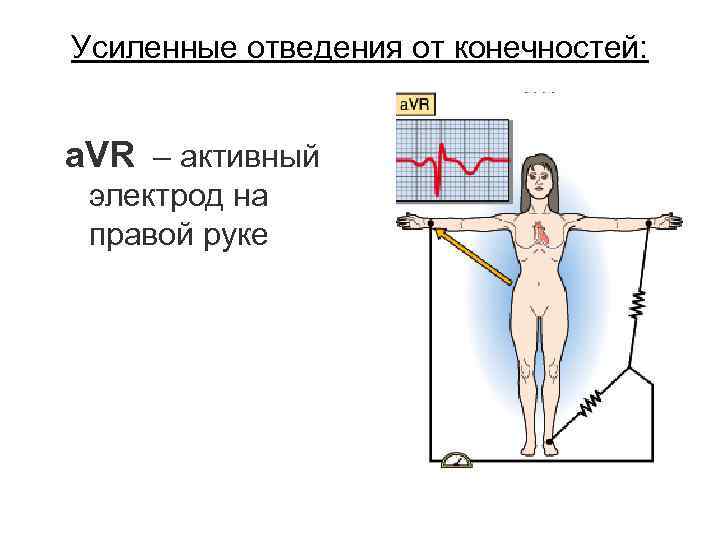 Усиленные отведения от конечностей: a. VR – активный электрод на правой руке 