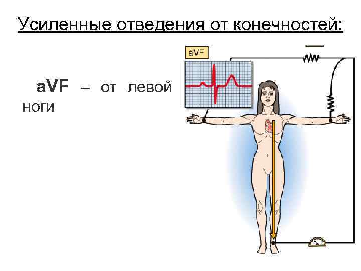 Усиленные отведения от конечностей: a. VF – от левой ноги 