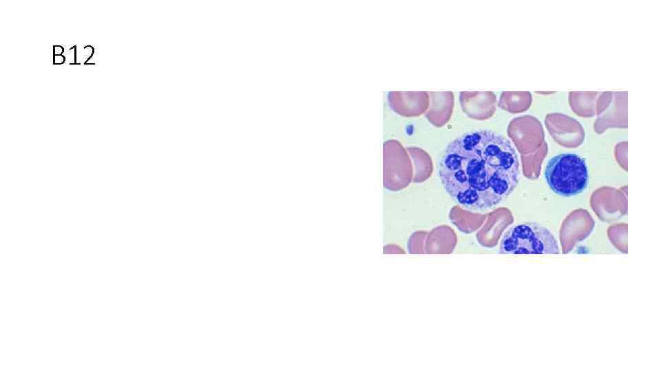 B 12 