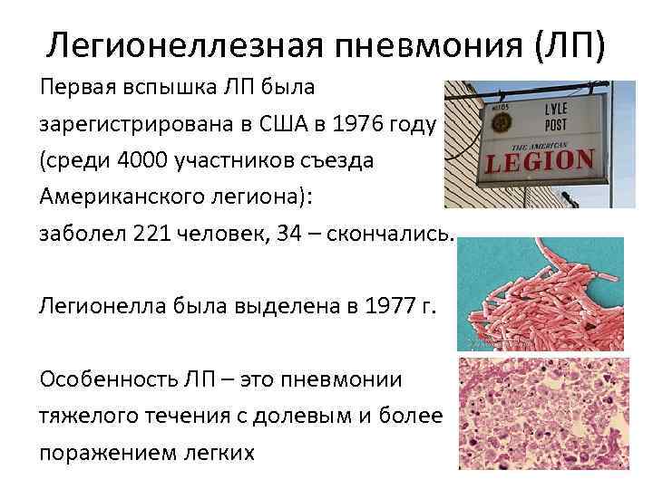 Легионеллезная пневмония (ЛП) Первая вспышка ЛП была зарегистрирована в США в 1976 году (среди