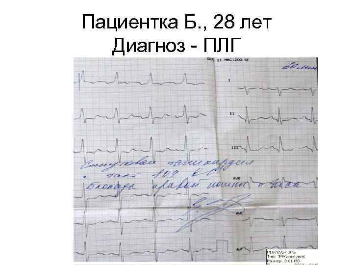 Пациентка Б. , 28 лет Диагноз - ПЛГ 