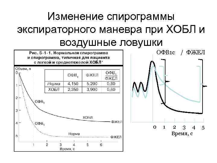Изменение спирограммы экспираторного маневра при ХОБЛ и воздушные ловушки ОФВ 1 с / ФЖЕЛ