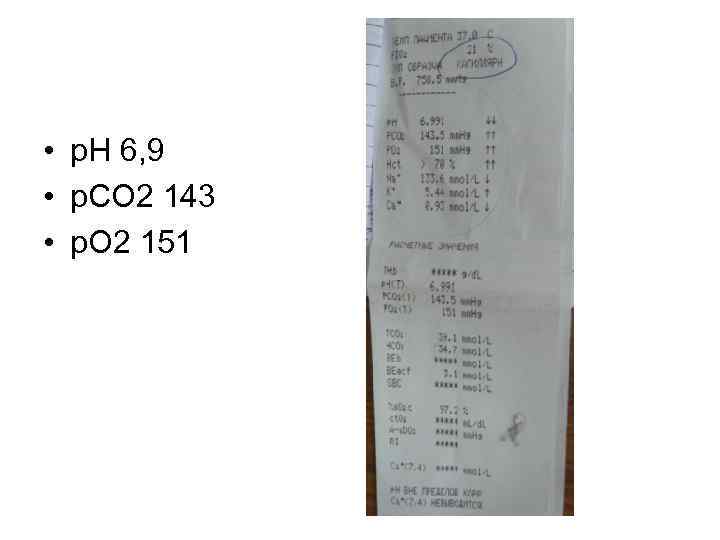  • р. Н 6, 9 • р. СО 2 143 • р. О