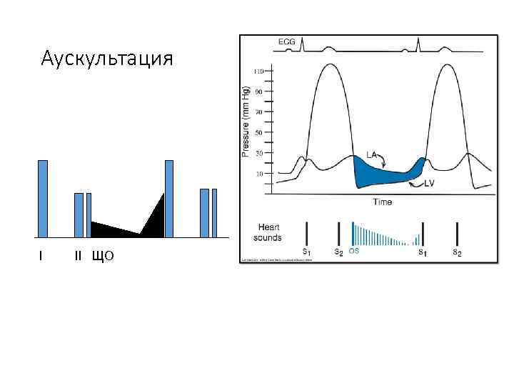 Аускультация I II ЩО 