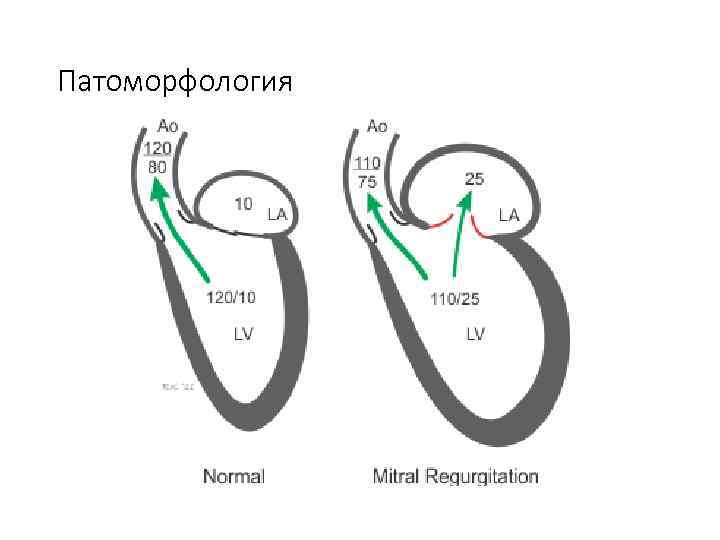 Патоморфология 
