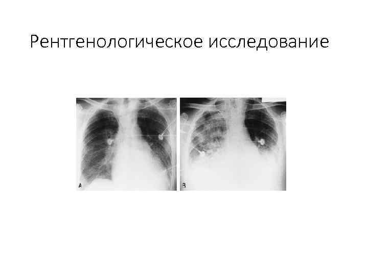 Рентгенологическое исследование 