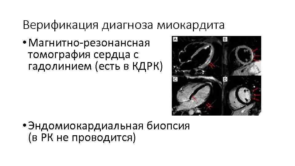 Мрт Сердца Цена В Москве Недорого К31