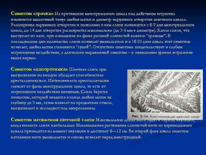 Симптом «зрачка» На протяжение менструального цикла под действием эстрогена изменяется мышечный тонус шейки матки