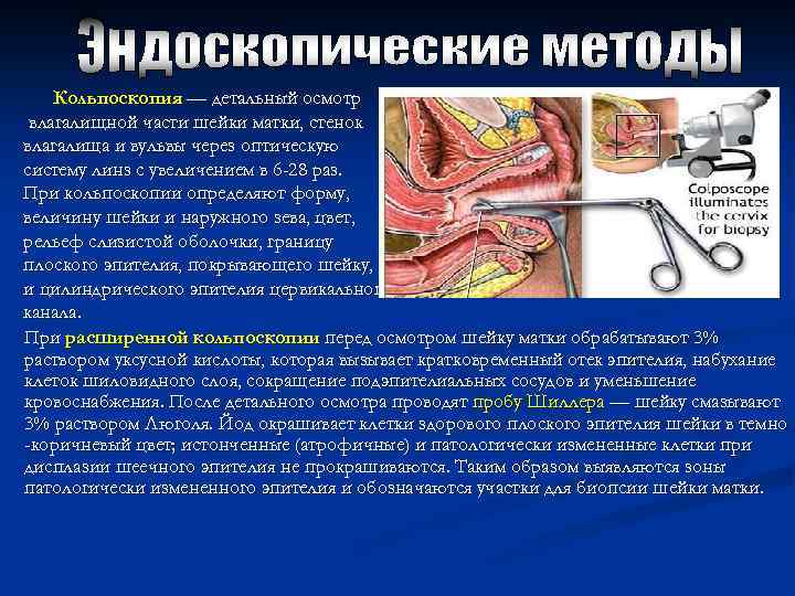 Кольпоскопия — детальный осмотр влагалищной части шейки матки, стенок влагалища и вульвы через оптическую