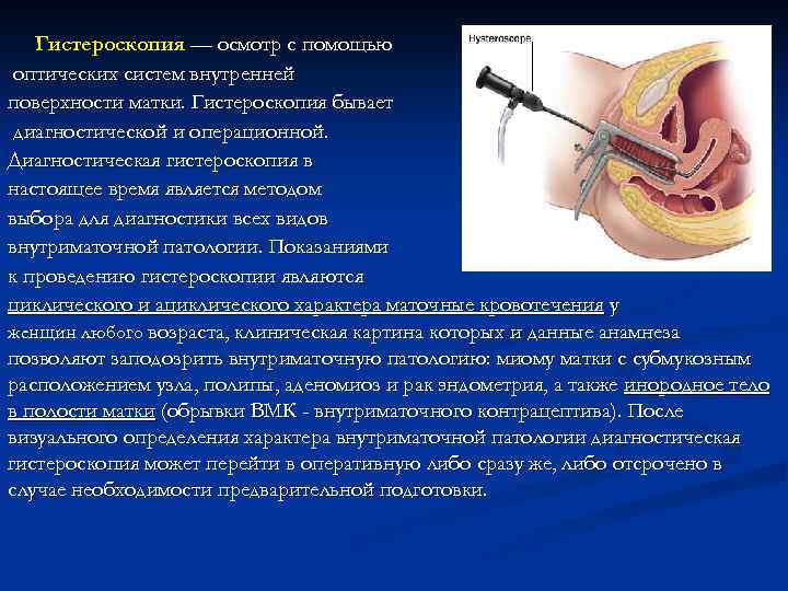 Гистероскопия — осмотр с помощью оптических систем внутренней поверхности матки. Гистероскопия бывает диагностической и