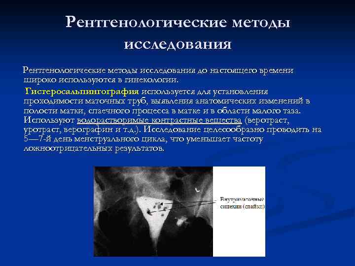 Рентгенологические методы исследования до настоящего времени широко используются в гинекологии. Гистеросальпингография используется для установления