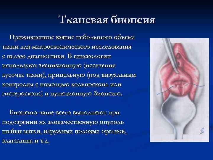 Тканевая биопсия Прижизненное взятие небольшого объема ткани для микроскопического исследования с целью диагностики. В